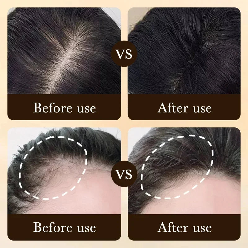 Advanced Scalp Renewal Serum