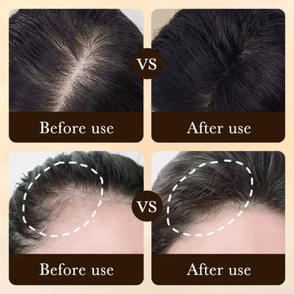 Advanced Scalp Renewal Serum